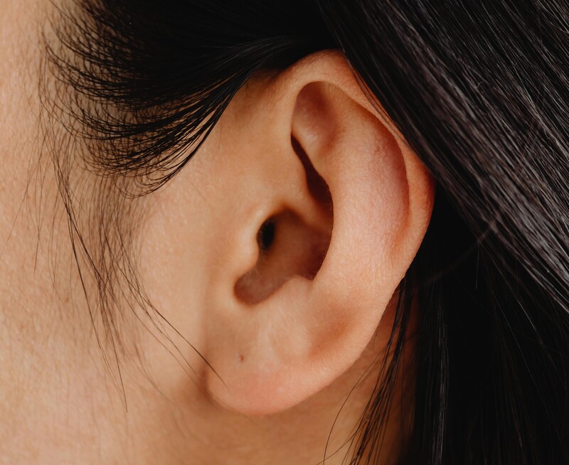 before and after results of Ear Surgery Otoplasty by Dr. Weiss